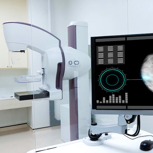 O programa de qualidade em mamografia consiste em fazer avaliações periódicas do sistema de revelação e da qualidade da imagem, garantindo uma boa confiabilidade no exame e maior precisão diagnóstica.